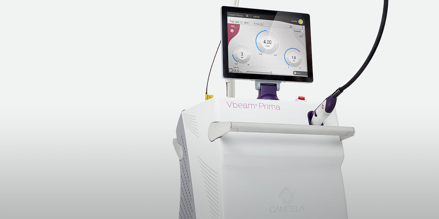 Vbeam Prima Gold Standard 595 & 1064 nm System Candela Medical
