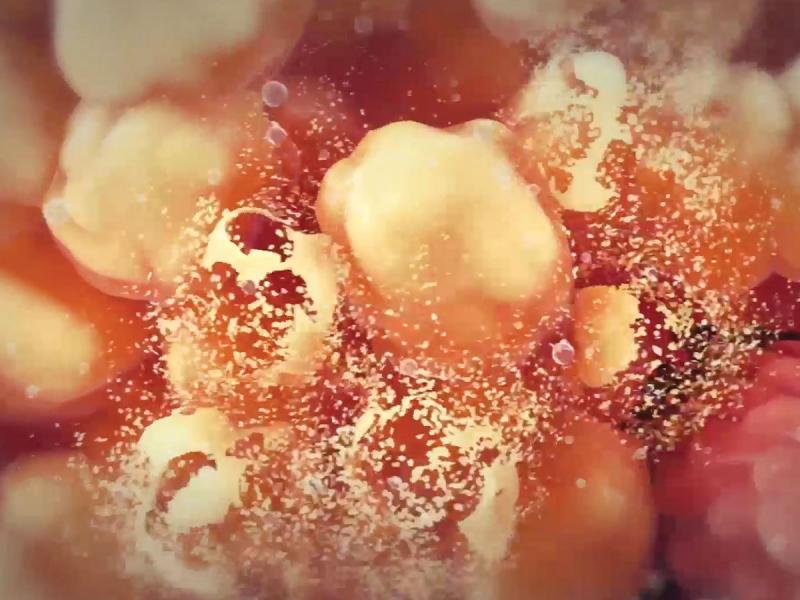 Photo Illustrating Oscillating High Pressure From UltraShape Power Treatment that Induces Fat Cell Destruction Photo of fat cell destruction due to oscillating high pressure destroys fat cells membranes during UltraShape Power treatment.