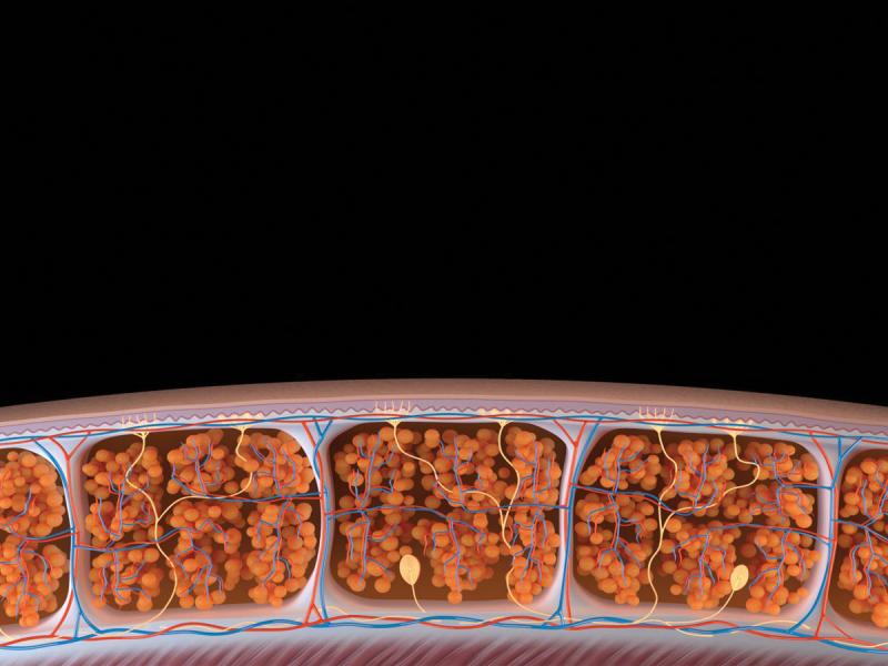 Photo Illustrating Destroyed Fat Cells Being Processed by the Body's Natural Physiological and Metabolic Pathways After UltraShape Power Treatment Photo illustrating destroyed fat cells being naturally processed by the body after UltraShape Power body contouring treatment.